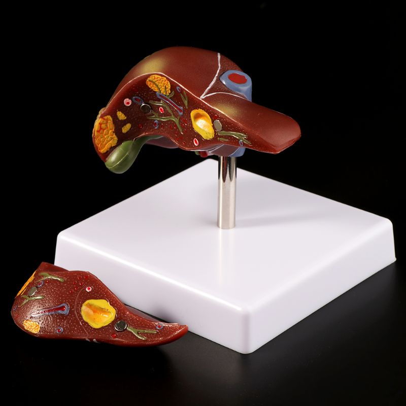 Human Liver Pathological Anato - огляд і ціна Medical Lab Design