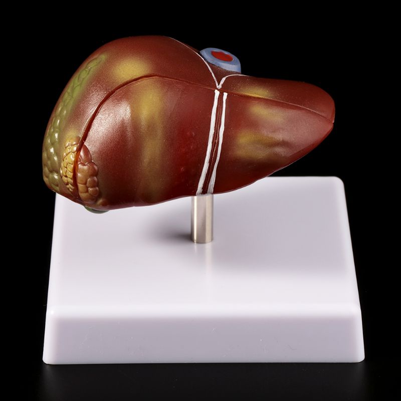 Human Liver Pathological Anato - огляд і ціна Medical Lab Design