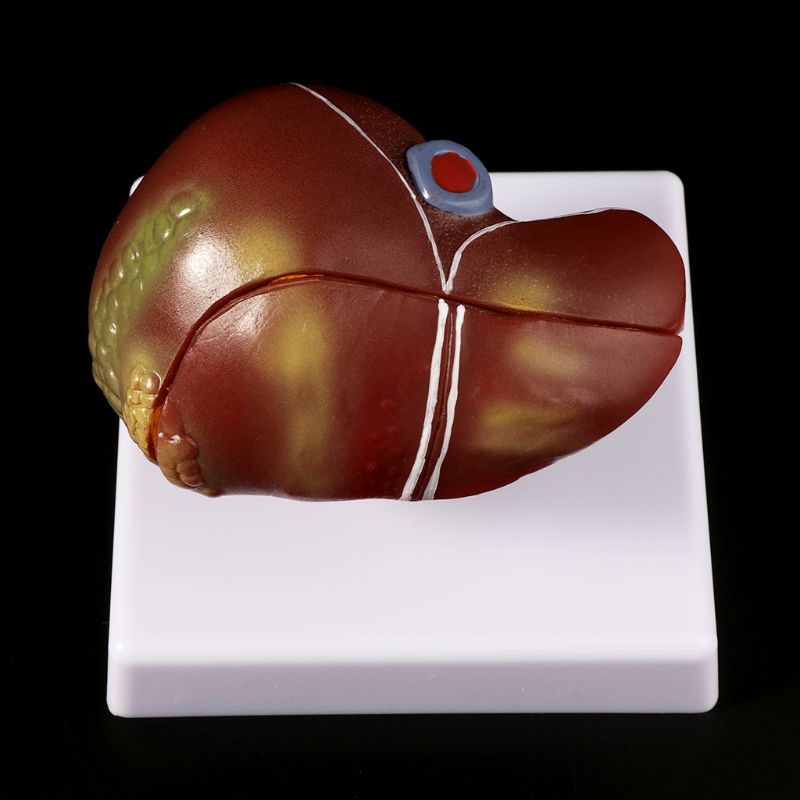 Human Liver Pathological Anato - огляд і ціна Medical Lab Design