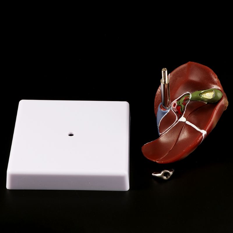 Human Liver Pathological Anato - огляд і ціна Medical Lab Design